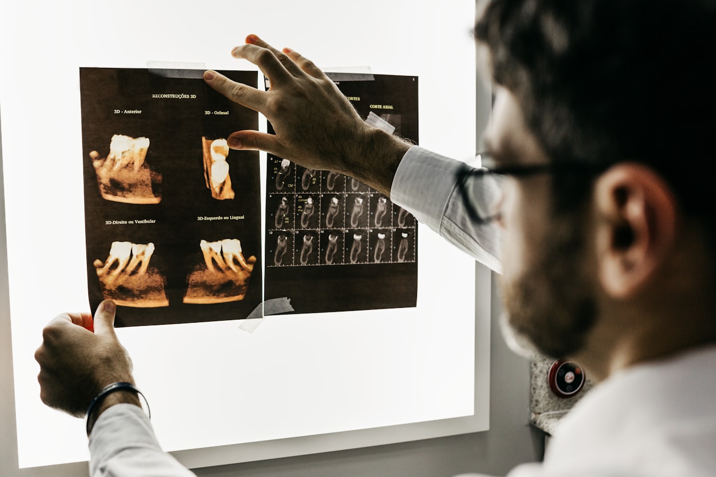 Diagnóstico con radiografía dental 3D
