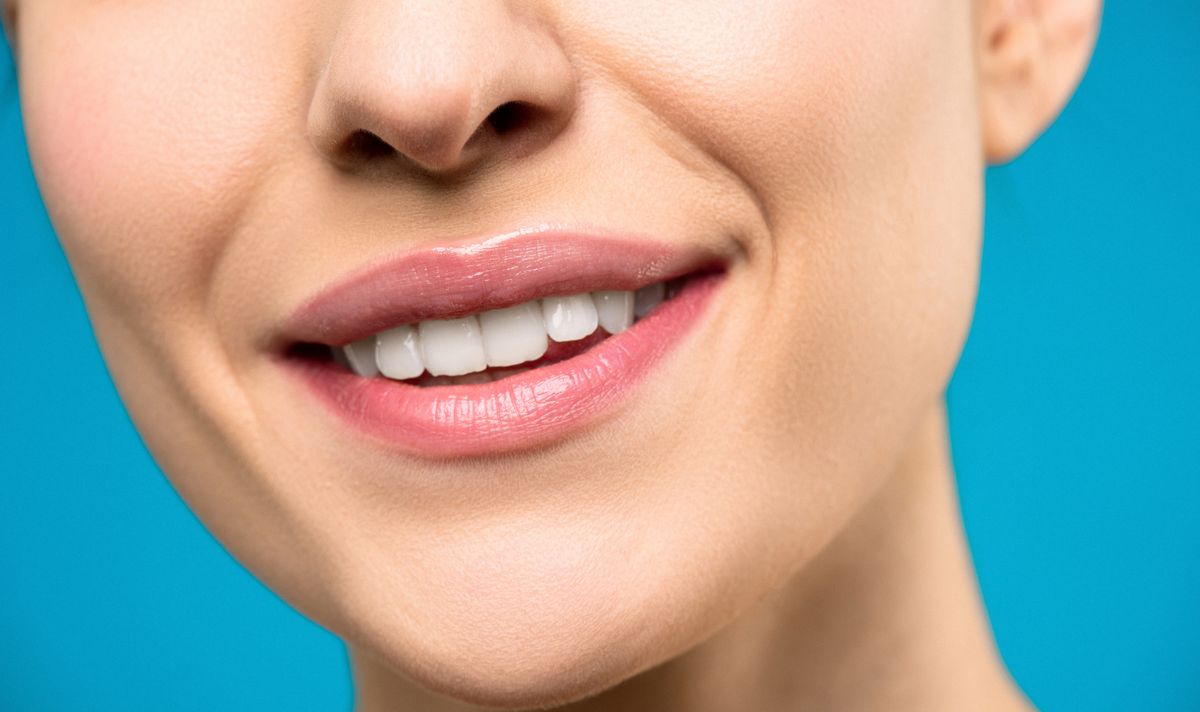 Sonrisa tras blanqueamiento dental
