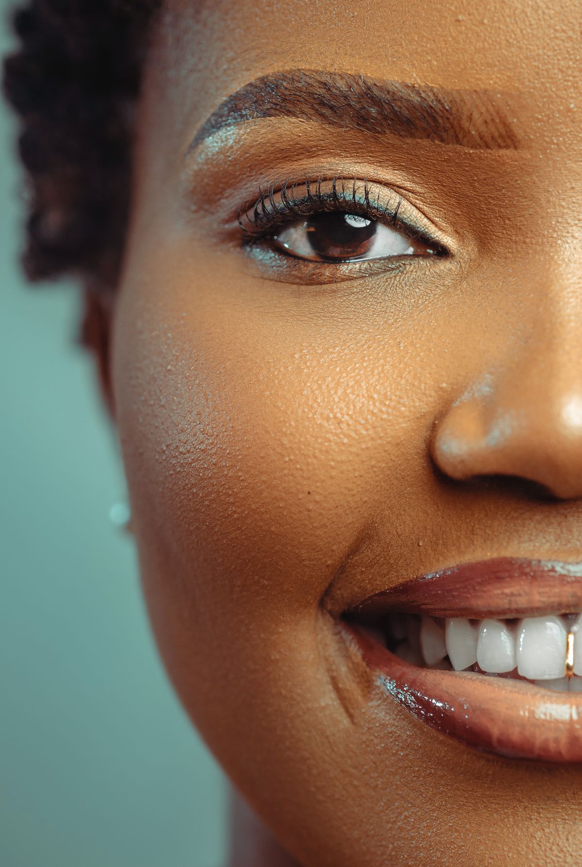 Sonrisa sana tras estética dental